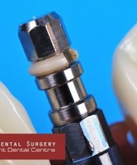 Oliver Dental Surgery (Katong)